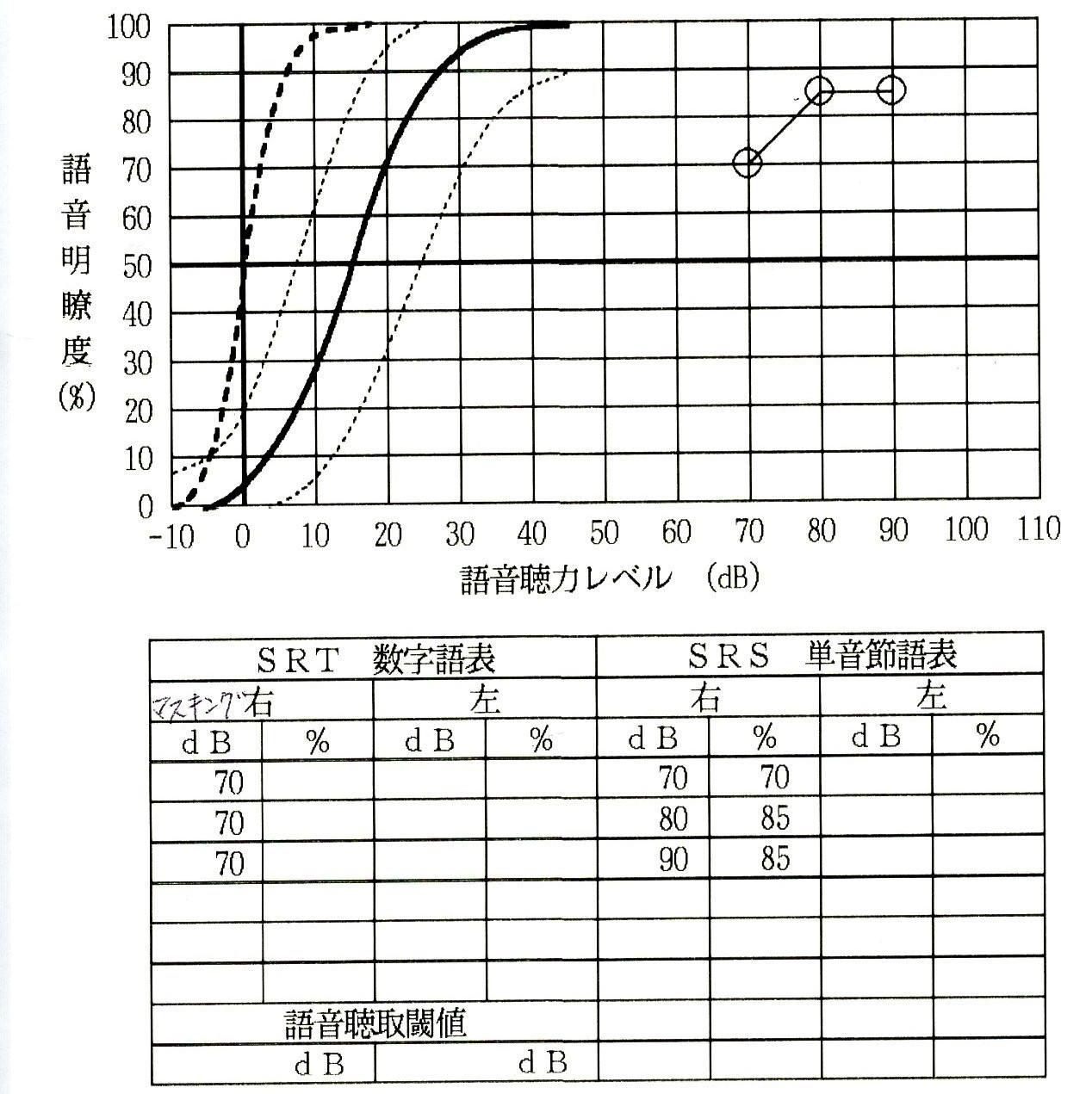 語音検査