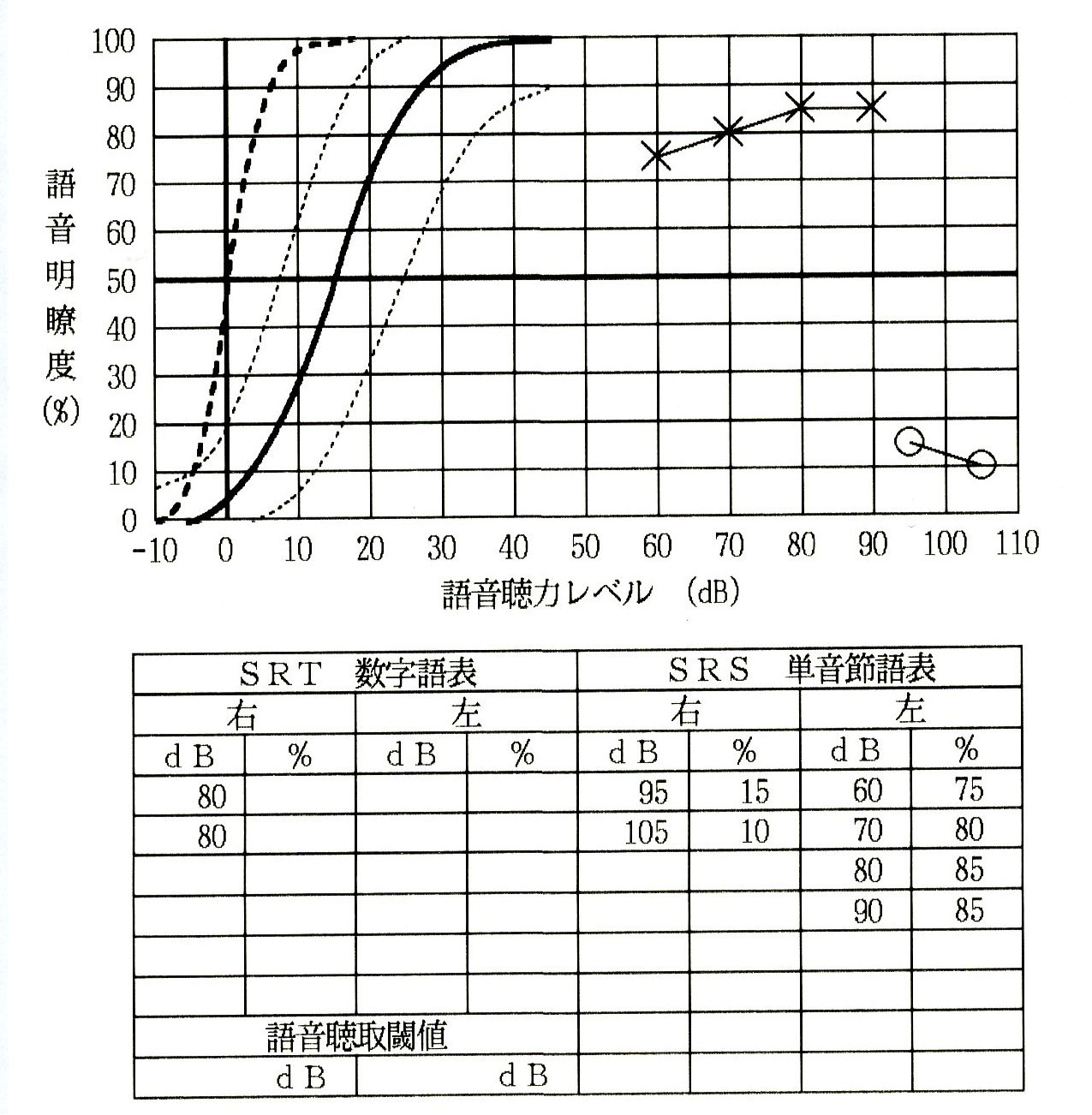 語音検査