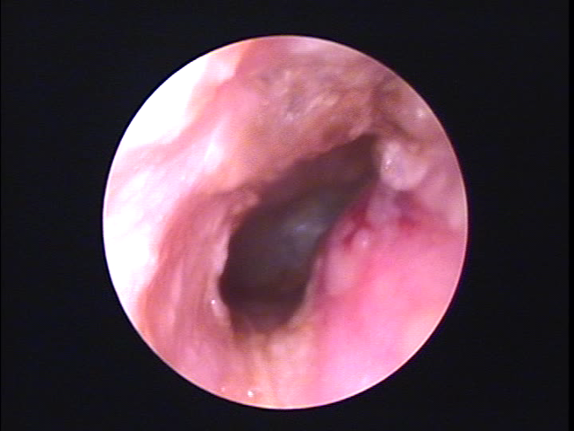 外耳炎の写真（画像）