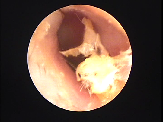 掃除 1 歳 耳 子供の耳掃除はピンセットでできる？耳かきのコツとおすすめピンセット